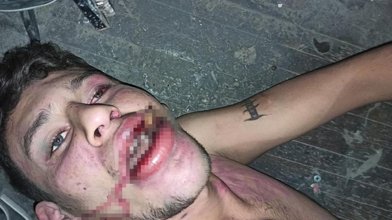 Antalya'da hamam böceği yedirilen gencin dosyasında karar verildi